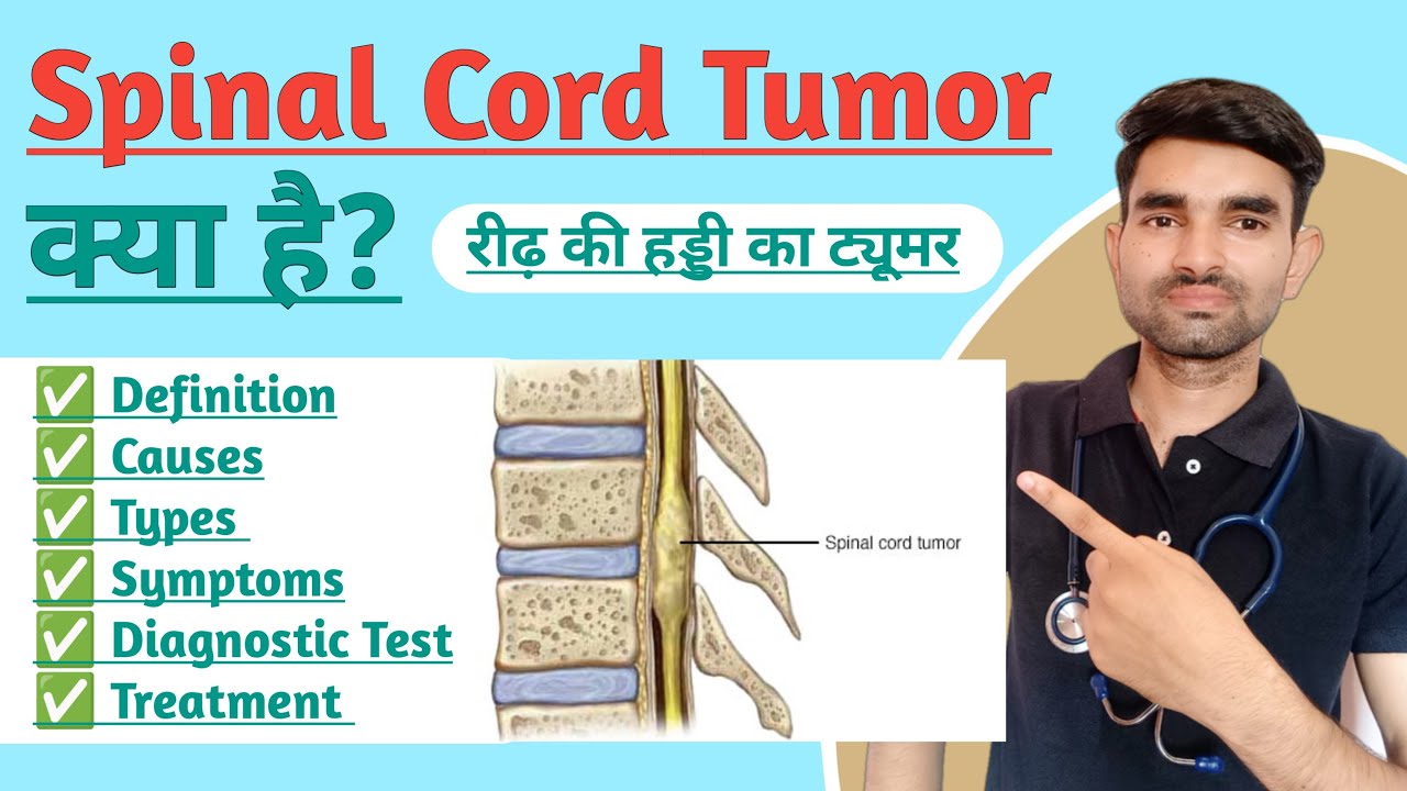 Spinal Cord Tumor in Hindi | Causes, Types, Symptoms And Treatment of Spinal Cord Tumor