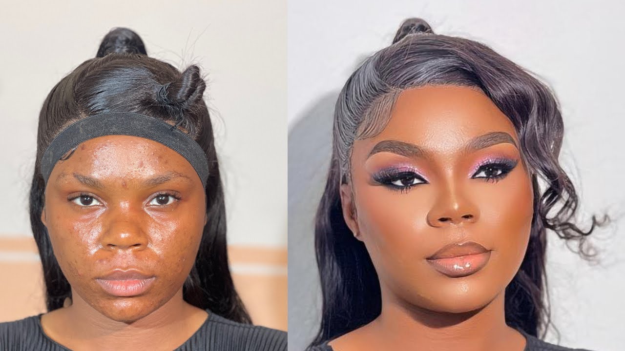 MAKEUP TRANSFORMATION TUTORIAL FOR ACNE PRONE TO SKIN