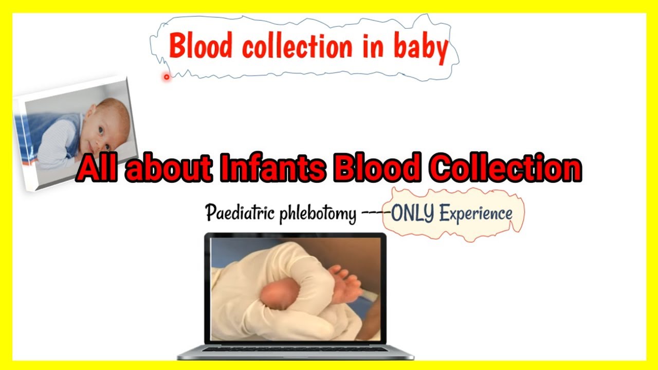 baby blood collection || Newborn || infant blood collection with different method