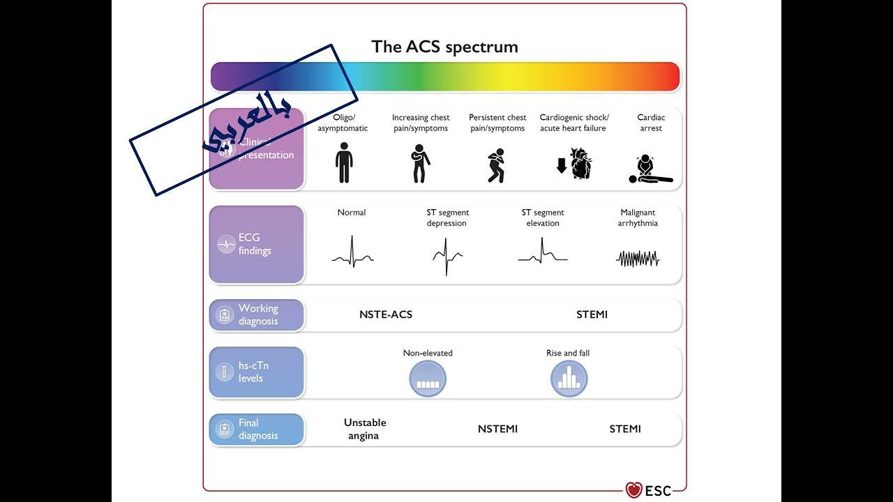 ESC Guidelines of ACS: 1. Diagnosis & Triage of ACS (Arabic Version)