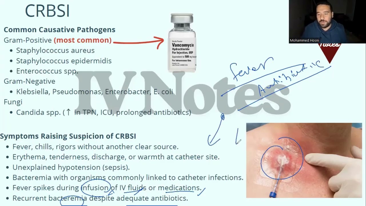 حركة صايعة تخليك تكتشف إذا كان السنتر بتاعك infected ولا لأ