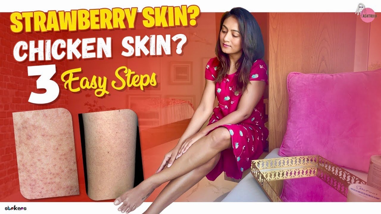 STRAWBERRY SKIN ? || CHICKEN SKIN ? || Tips & Tricks