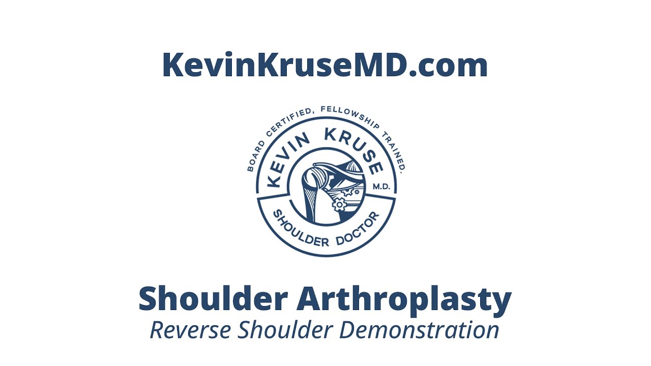 Reverse Shoulder Arthroplasty Demonstration - Dr Kevin Kruse MD