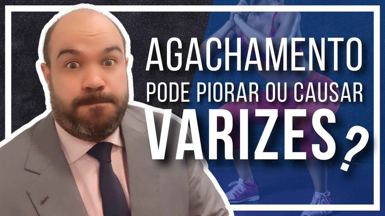 🔴 Agachamento faz aparecer ou piorar varizes? Quem tem varizes pode fazer?