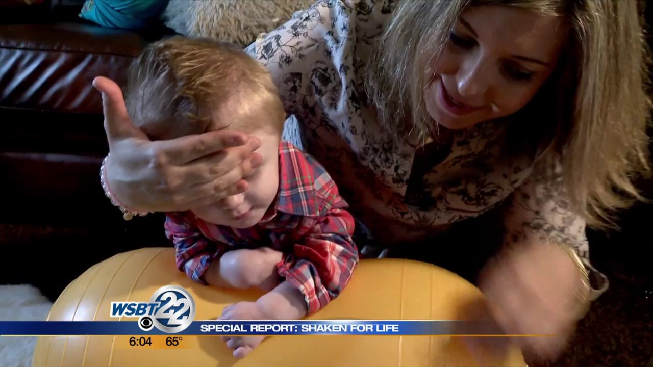 Shaken Baby Syndrome: The Survivors