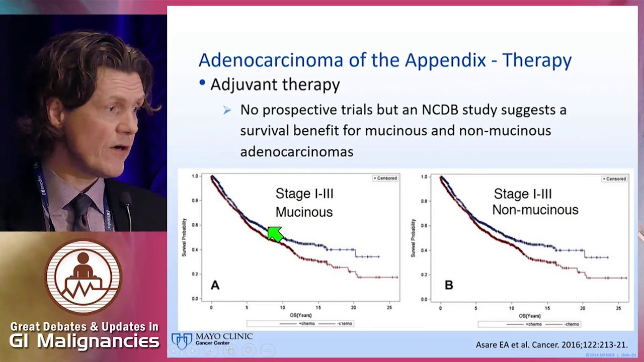 Management of appendiceal cancers: From pathology to treatment