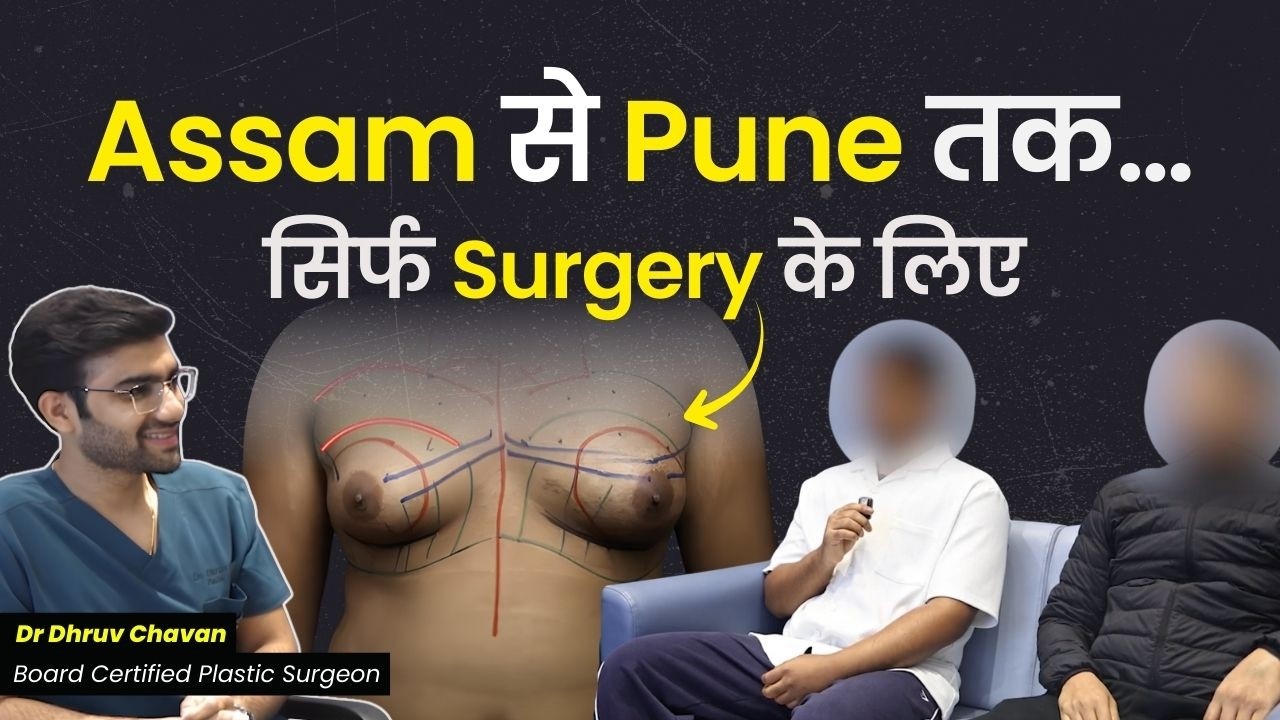 दो मरीज, एक फैसला: असम से पुणे Gynecomastia Surgery Experience. Dr.DC Plastic Surgeon India Pune