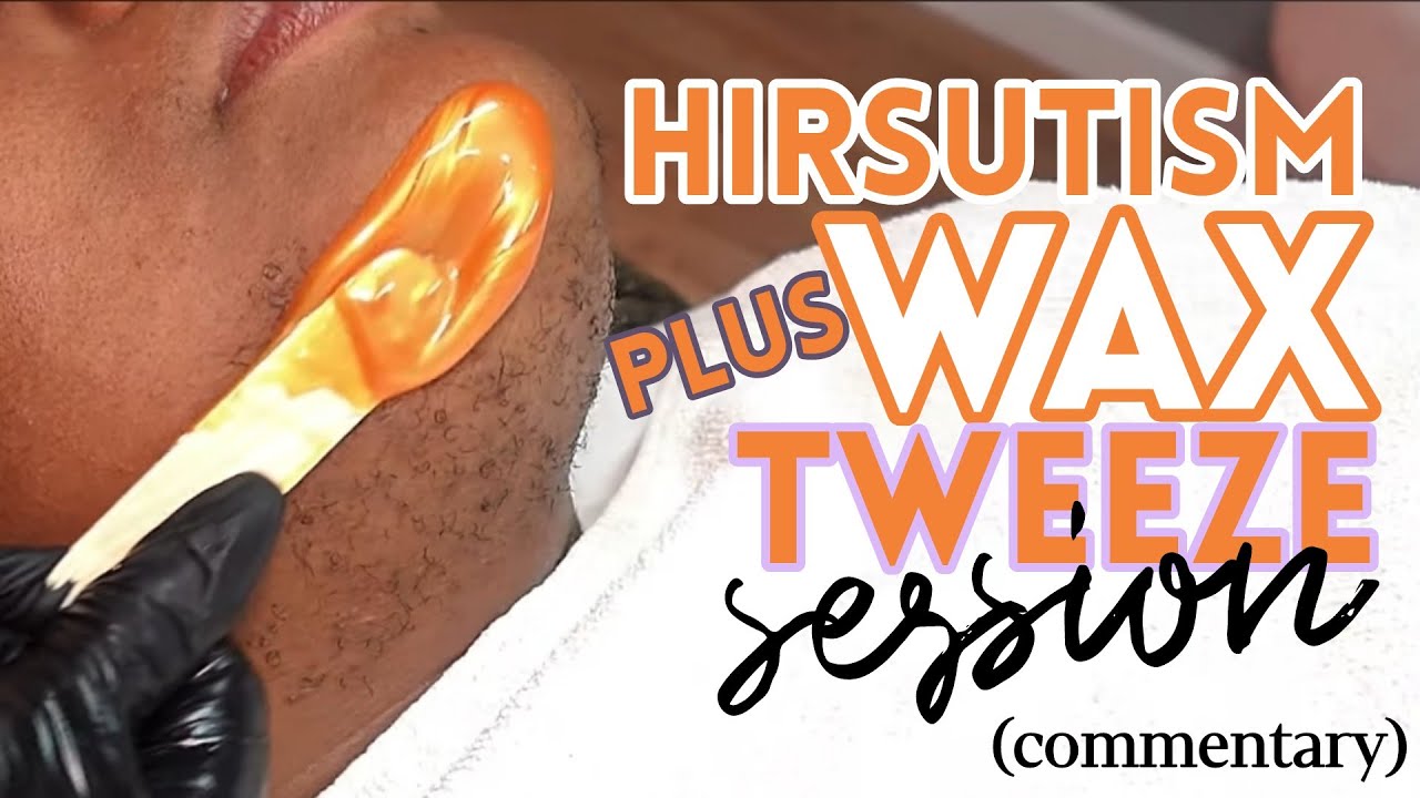 Hirsutism Facial Wax + Tweezing Session (COMMENTARY)