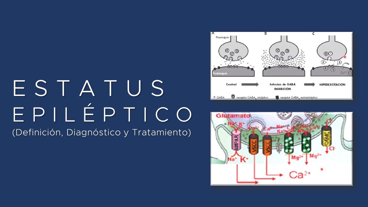 #Estatus #Epileptico (Definición, Fisiopatología, Diagnóstico y Tratamiento)