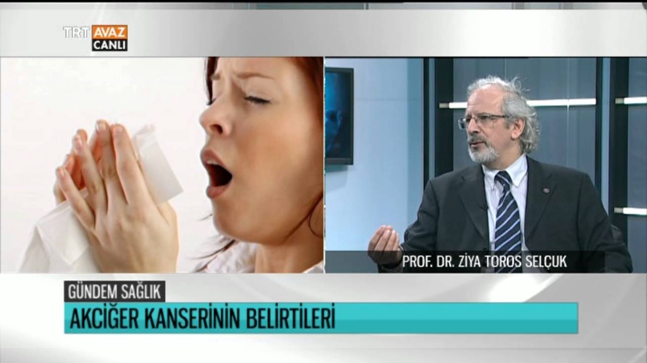 Akciğer Kanserinin Belirtileri - Prof. Dr. Ziya Toros Selçuk Anlatıyor - Gündem Sağlık - TRT Avaz