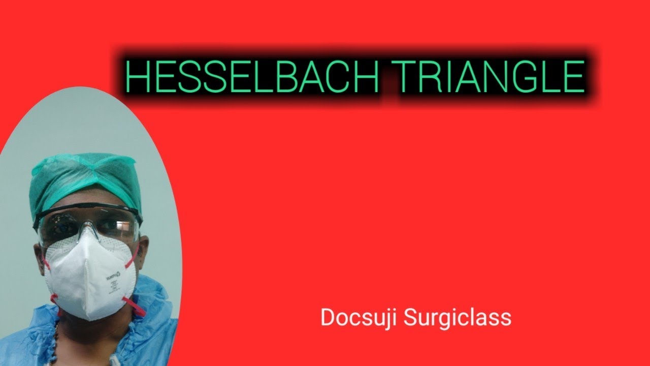 HESSELBACH TRIANGLE
