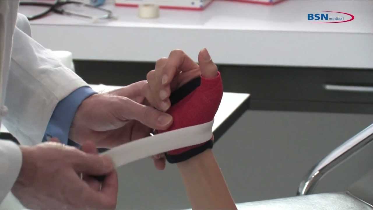 Synthetic casting removable gamekeeper application_EN_by BSN medical.mov