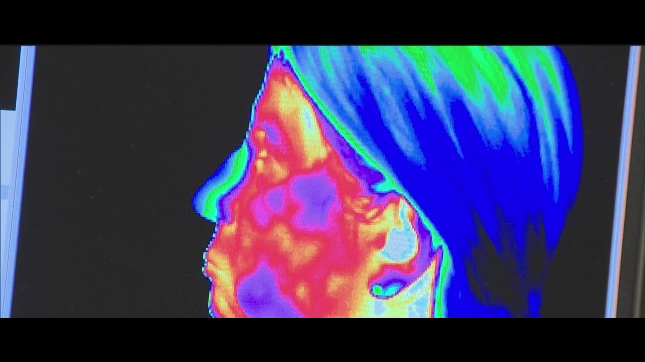 New York doctor adopts thermography as alternative to painful biopsies