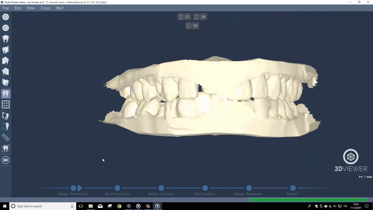 DentalCad 6.2 - Model Maker
