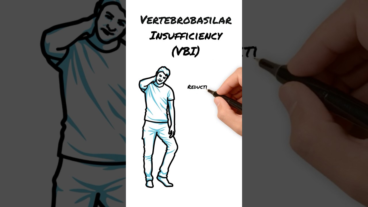 What is Vertebrobasilar Insufficiency?