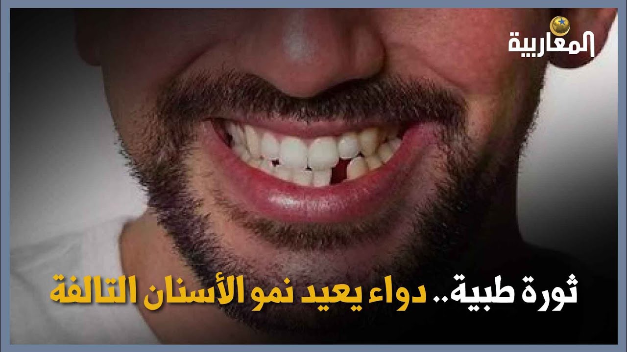 ثورة طبية.. دواء يعيد نمو الأسنان التالفة