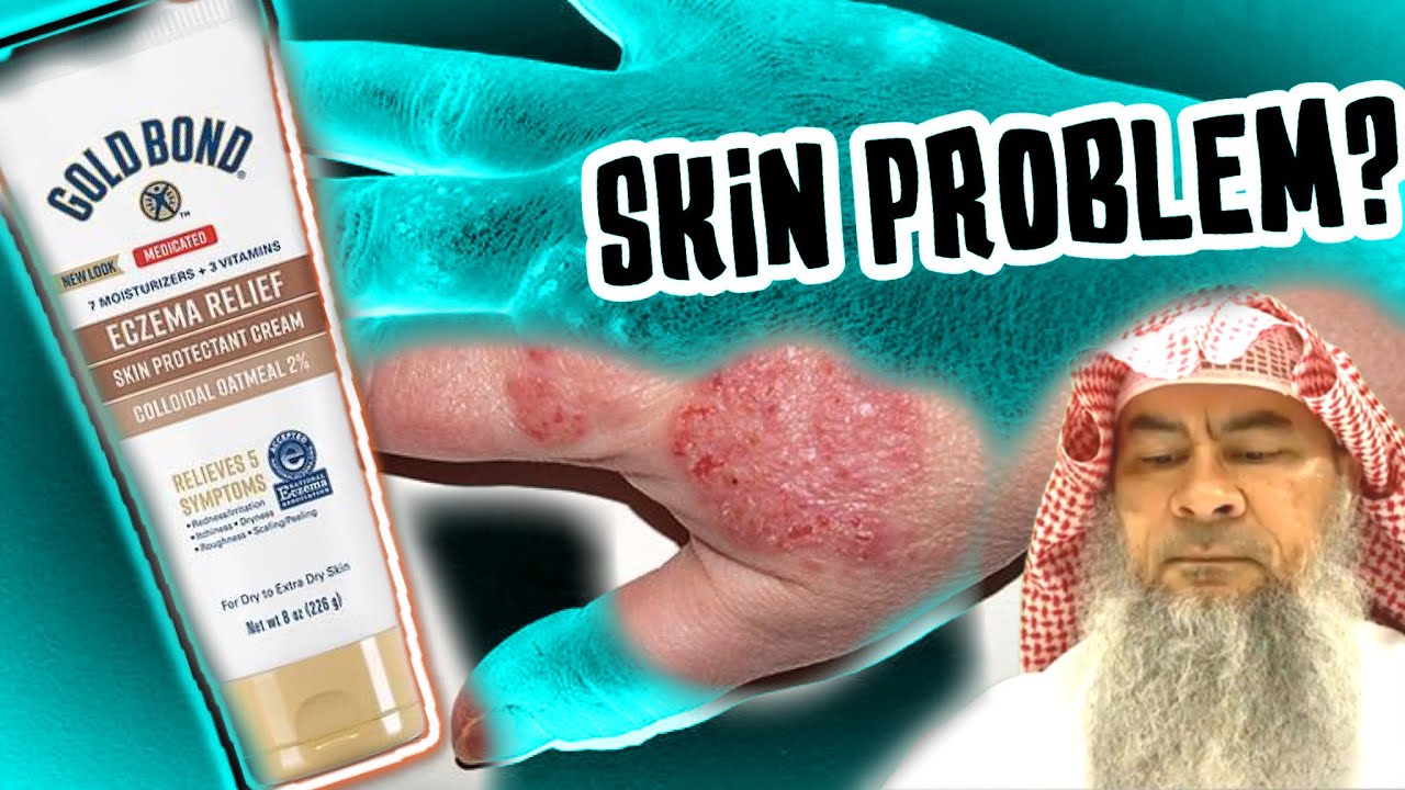 She has a skin problem & needs to apply cream, can she make Tayammum