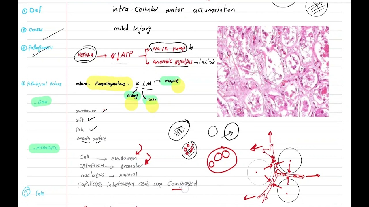 lec 3 ( reversible cell injury )