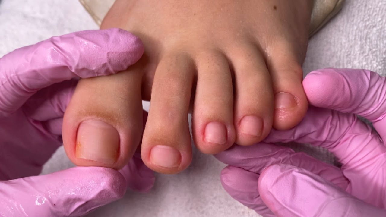 Cutilagem completa de Pé - Manicures