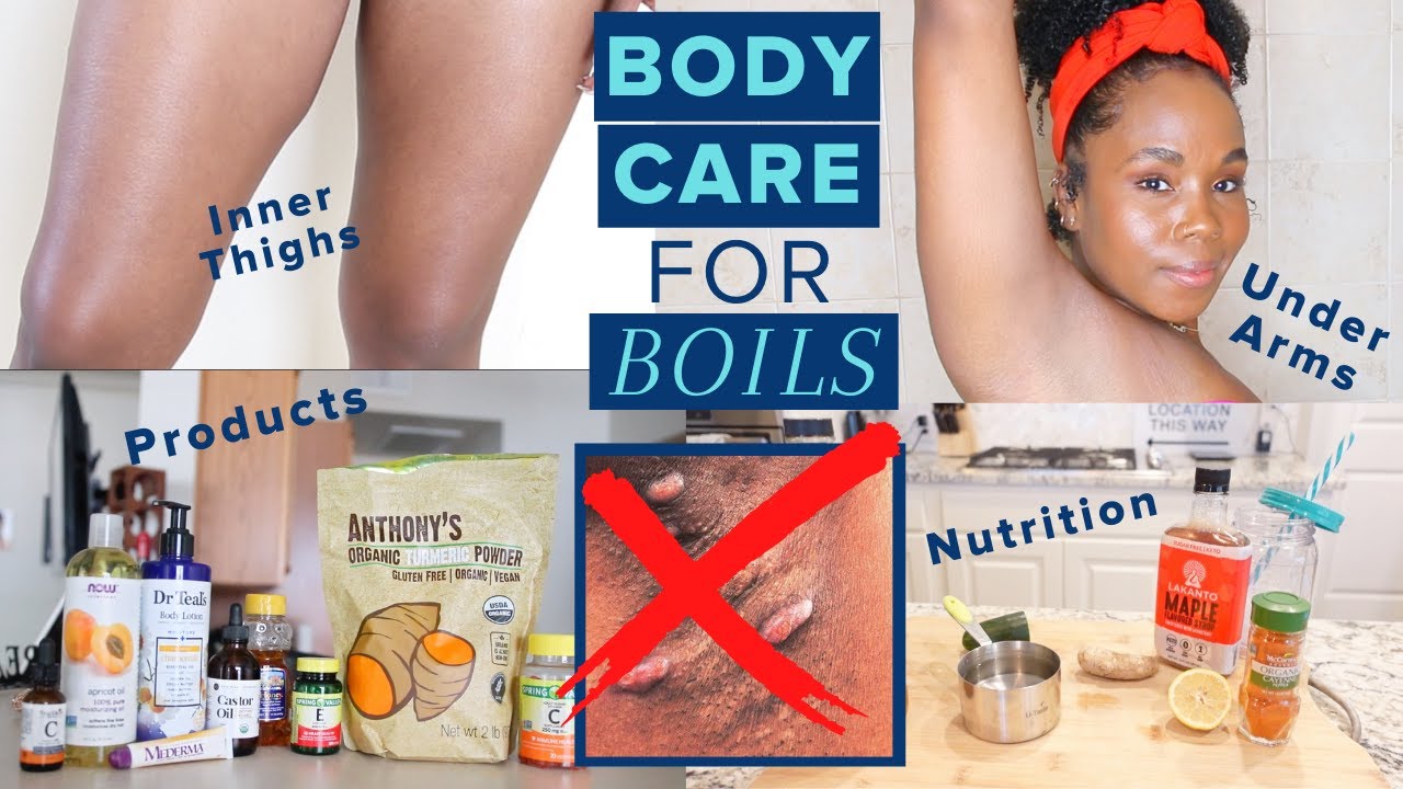 6 Ways to STOP Boils from Hidradenitis Suppurativa | SKIN CARE + BODY CARE + NUTRITION