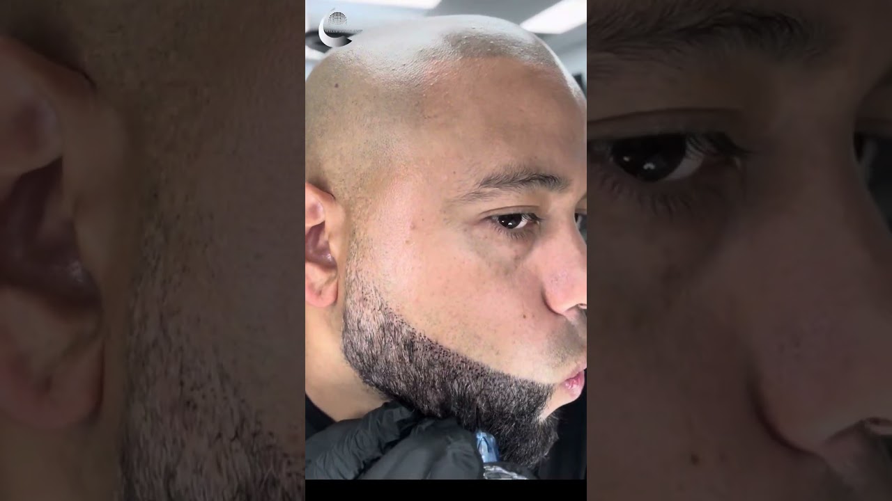 (BARBA TATUADA) proceso completo 