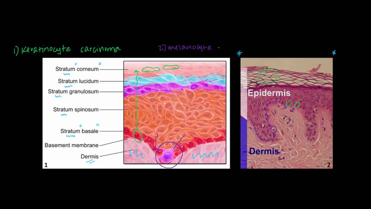 Introduction to Skin Cancer #1: Basic Histology and Anatomy