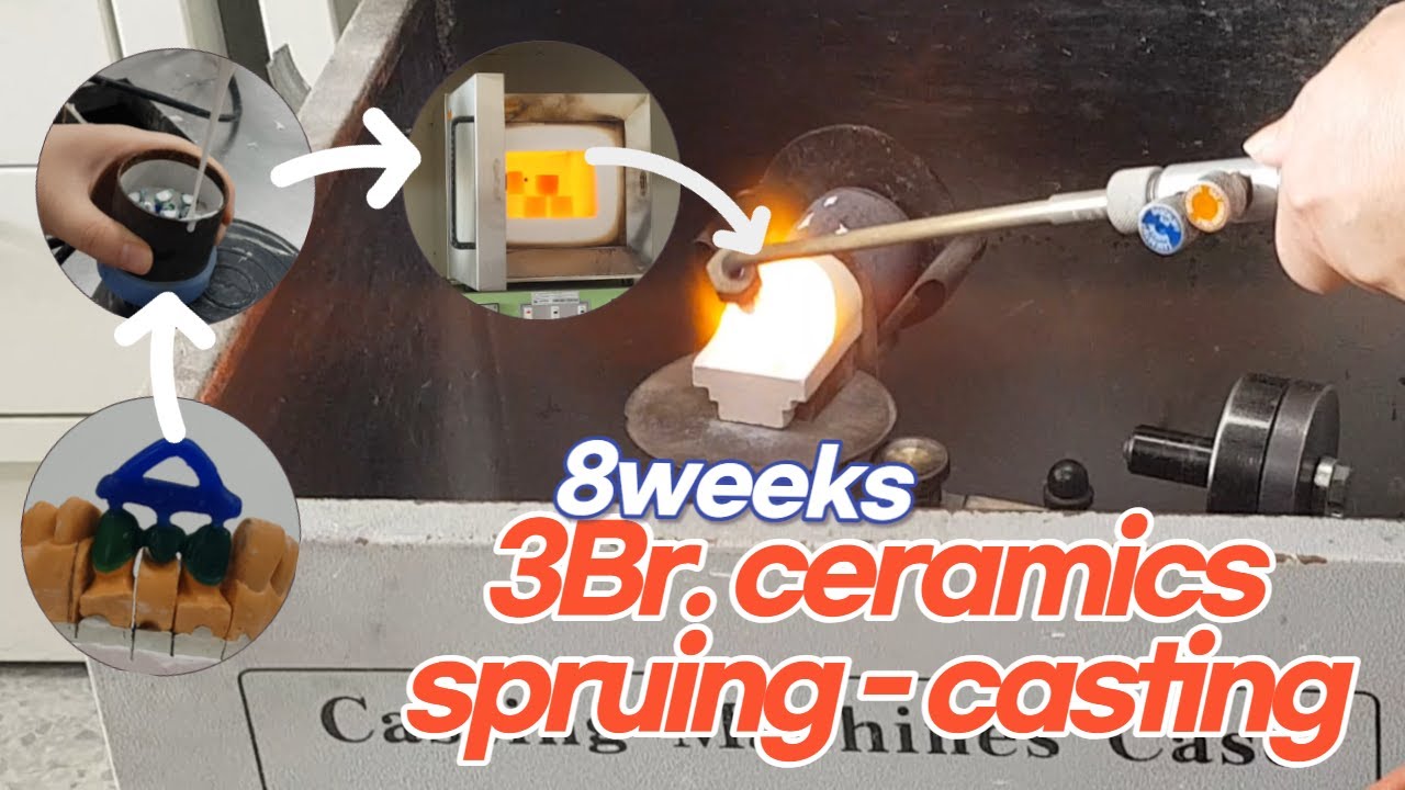 [ceramics|도재] spruing ~ casting