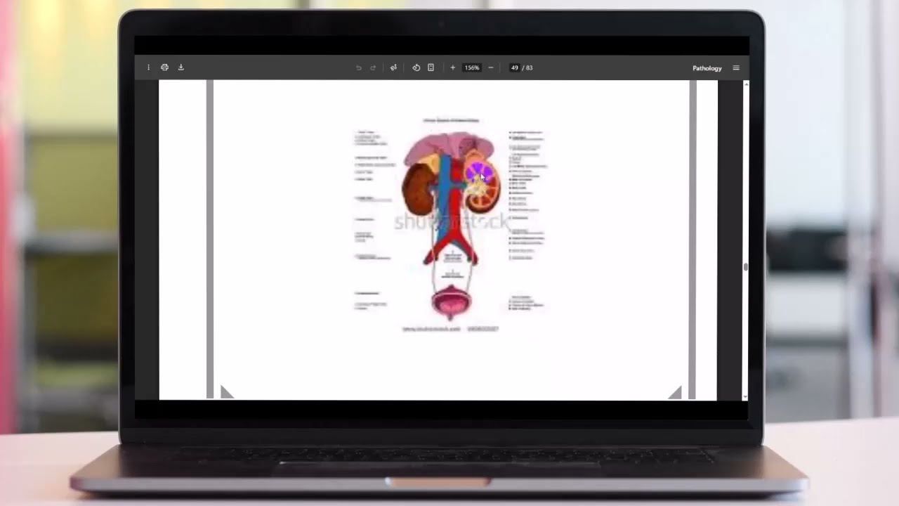 Chapter 6 | Renal Conditions