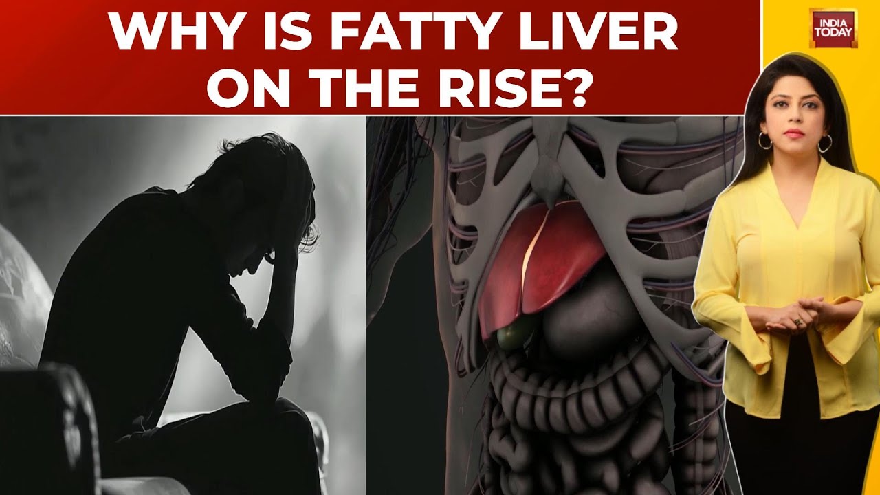 Fatty Liver Disease: Why Are Fatty Liver Cases On The Rise? | Health 360 With Sneha Mordani