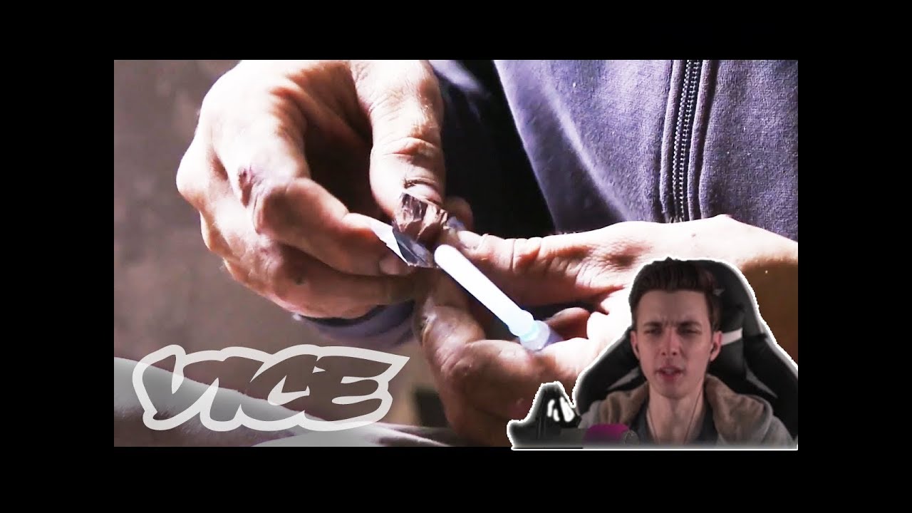 Хесус смотрит : Сибирь: крокодиловы слёзы (Krokodil: Russia's Deadliest Drug (NSFW))