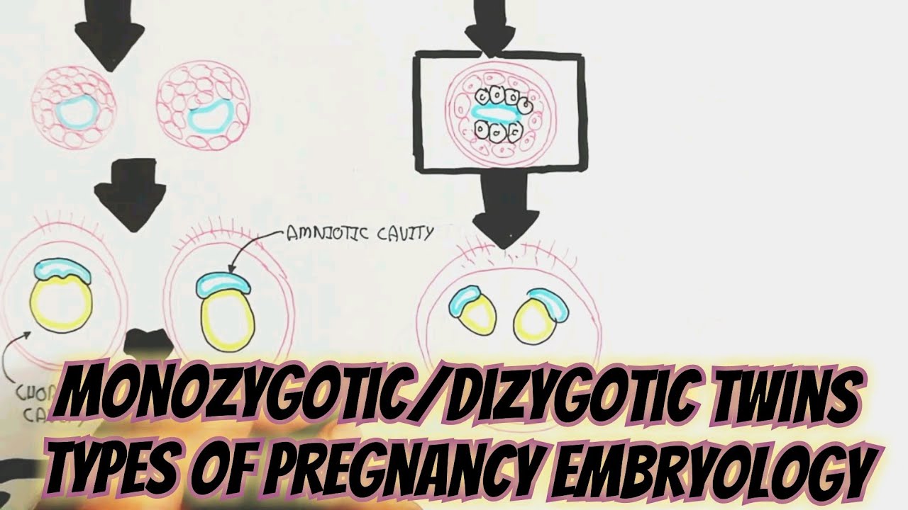 Monozygotic/Dizygotic Twins Types Of Pregnancy Embryology @umerfarooqbiology7083