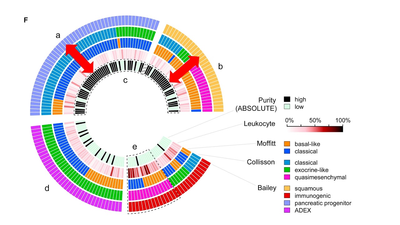 Molecular Subtype of PDAC