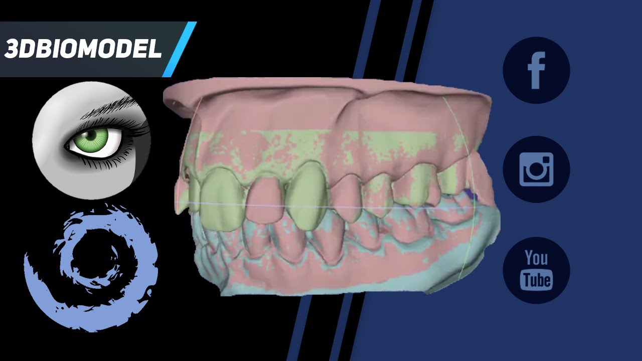 Come allineare modelli stl con Meshlab e BlueSkyPlan 4.7