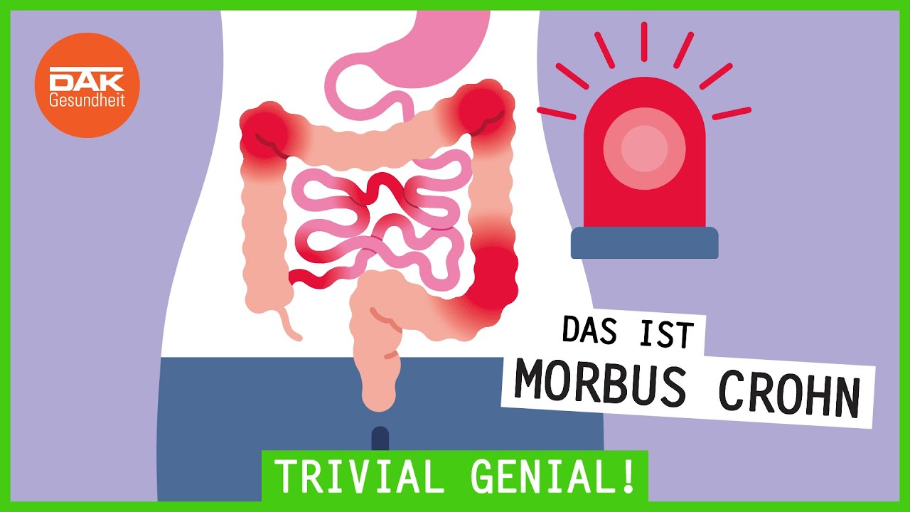 Das ist Morbus Crohn | #trivialgenial | DAK-Gesundheit