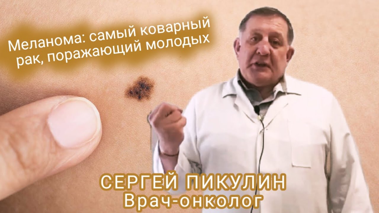 Меланома:  самый коварный рак, поражающий молодых Сергей Пикулин #онколог #медицина #новостисегодня