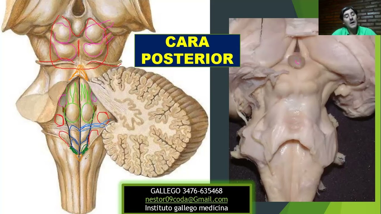 ANATOMIA FÁCIL. SISTEMA NERVIOSO. configuración externa tronco encefálico