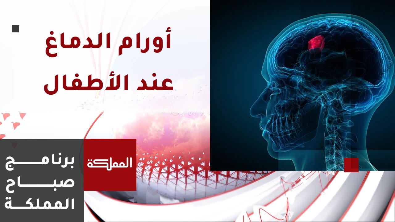 أورام الدماغ المسبب الأول للوفاة من السرطان عند الأطفال.. والكشف المبكر عنه يزيد فرص الشفاء