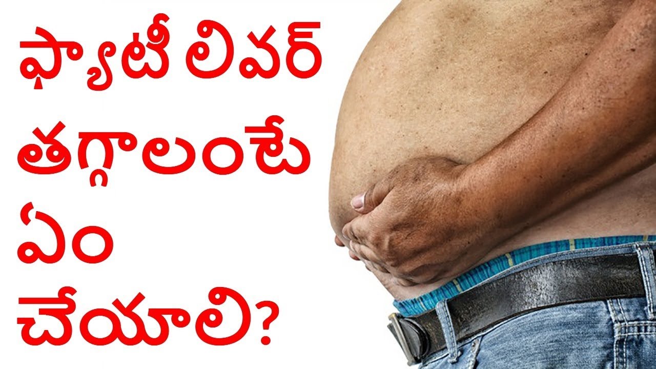 ఫ్యాటీ లివర్ తగ్గాలంటే ఏం చేయాలి? How to Cure Fatty Liver?
