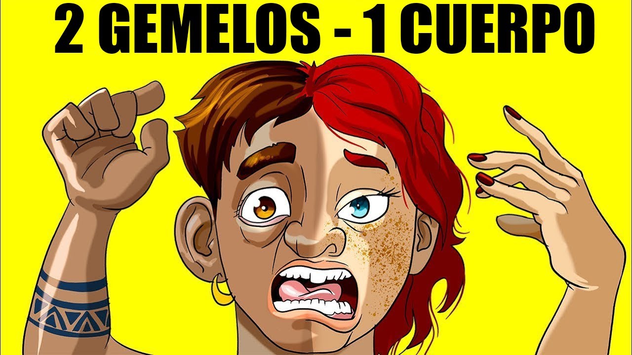 Increíbles Gemelos Que Son Uno en 1 Millón