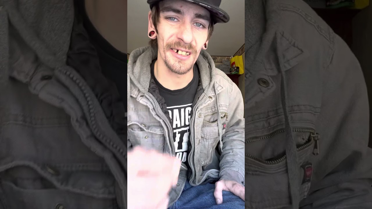 E-Day! 26 years Young, and getting dentures! Vlog update #1
