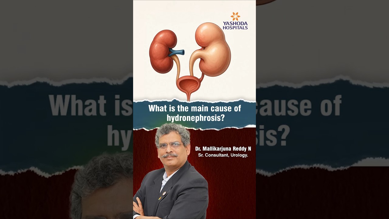 What is the Main Cause of Hydronephrosis? | Dr. Mallikarjuna Reddy N
