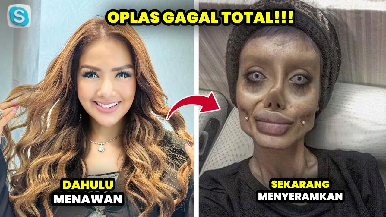 DULU TAMPIL MENAWAN! Wajah 8 Artis Ini Kini Berubah Drastis Akibat Gagal Oplas