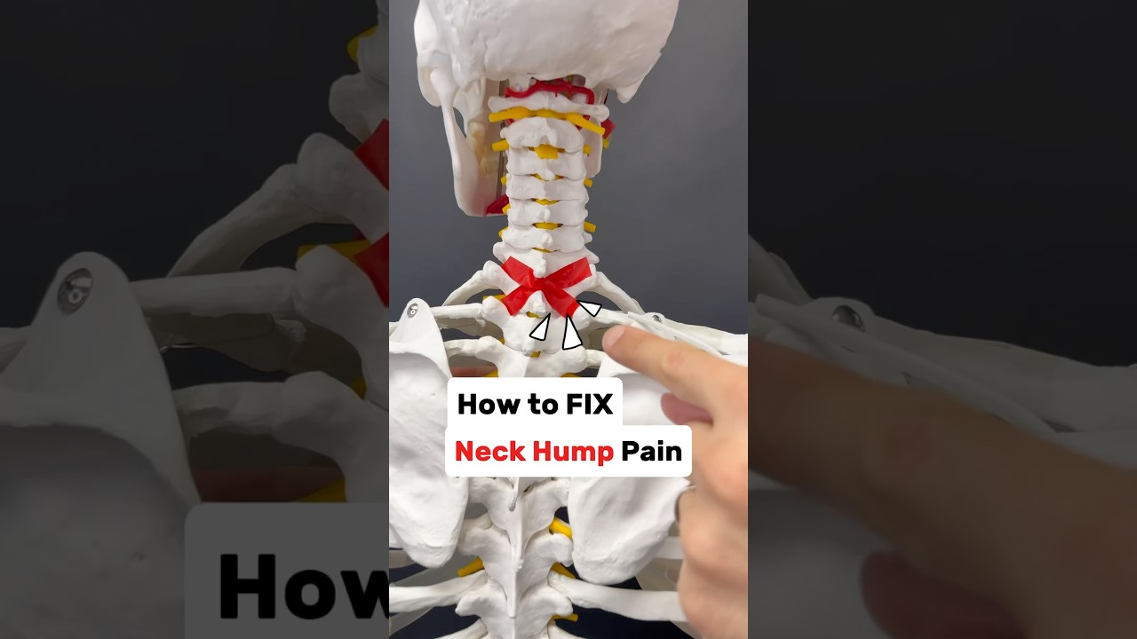 Painful neck hump? Let mobilize the CT Junction to get you some relief! #neckpain #neckpainrelief