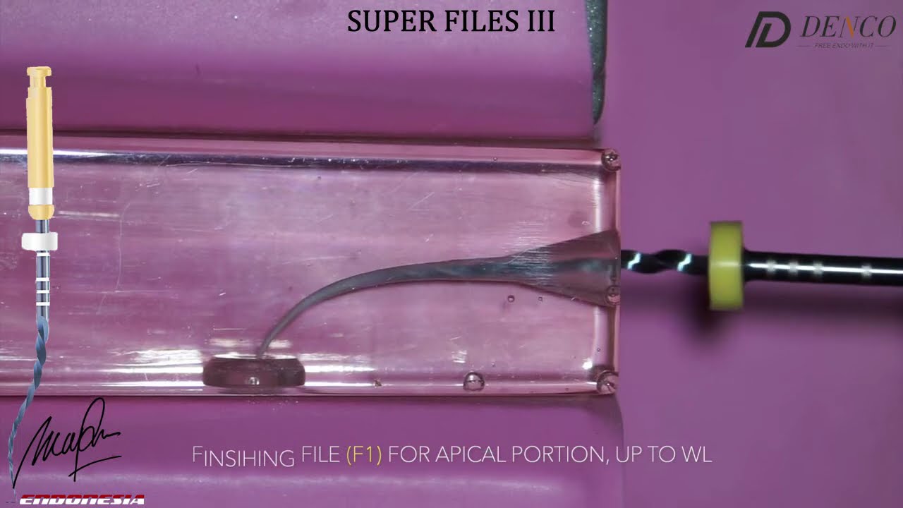 Denco Super Files III