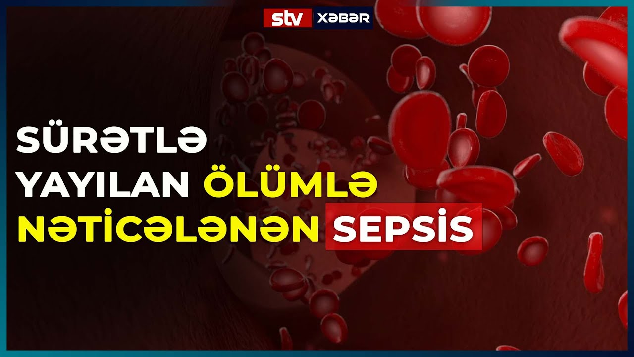 SÜRƏTLƏ YAYILAN ÖLÜMLƏ NƏTİCƏLƏNƏN SEPSİS - STV XƏBƏR