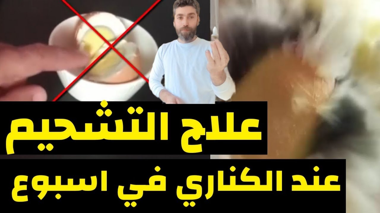 ودعا لأخطر مرض يصيب طيور الكناري و الحسون التشحيم المرضي والغذائي 