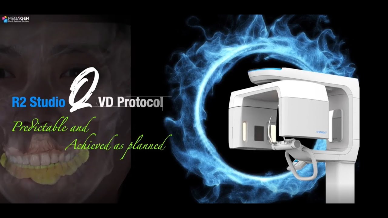 MegaGen R2 Studio QVD Protocol