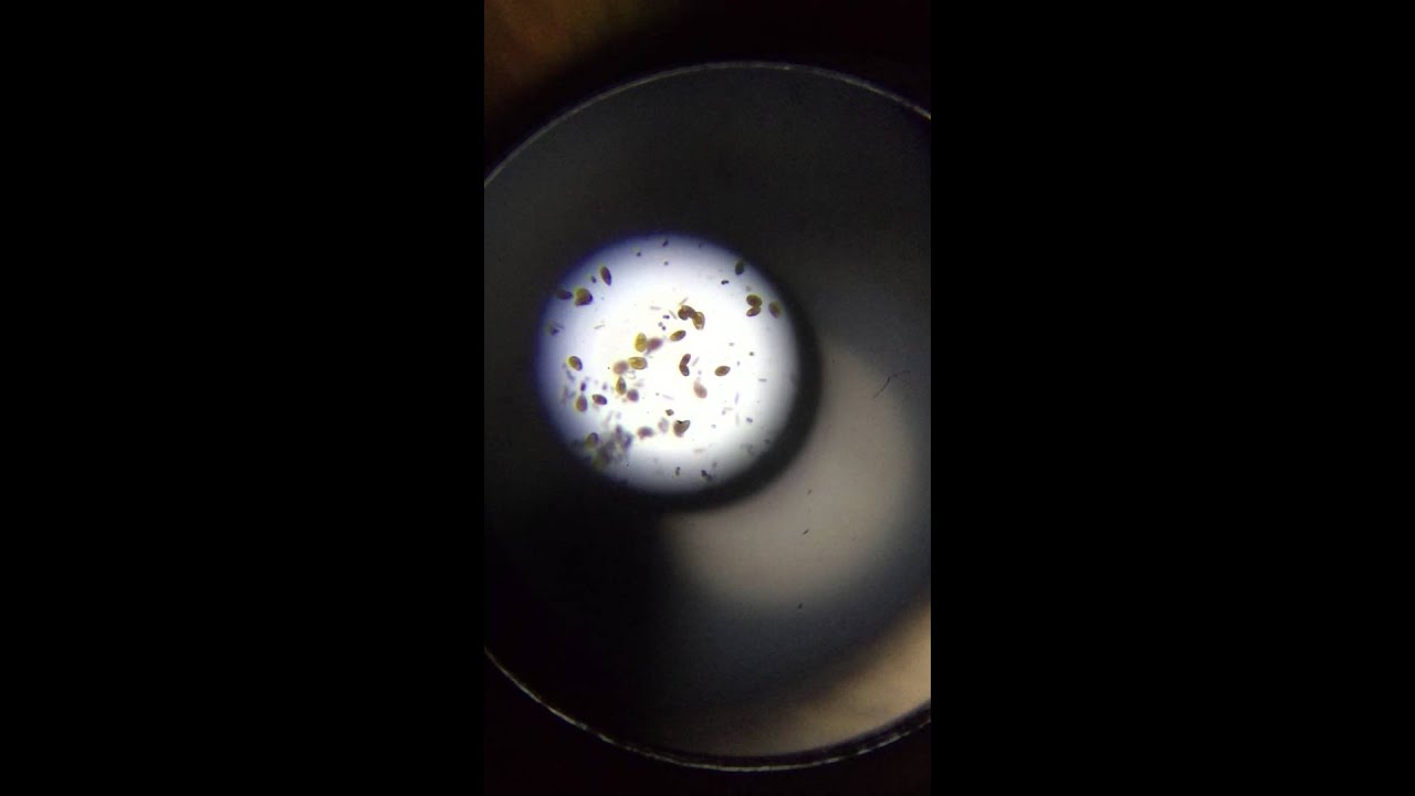 Dinoflagellat - Prorocentrum lima