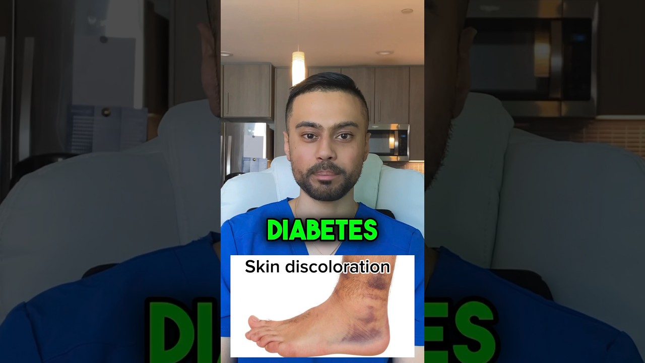 Diabetic Foot Skin Discoloration