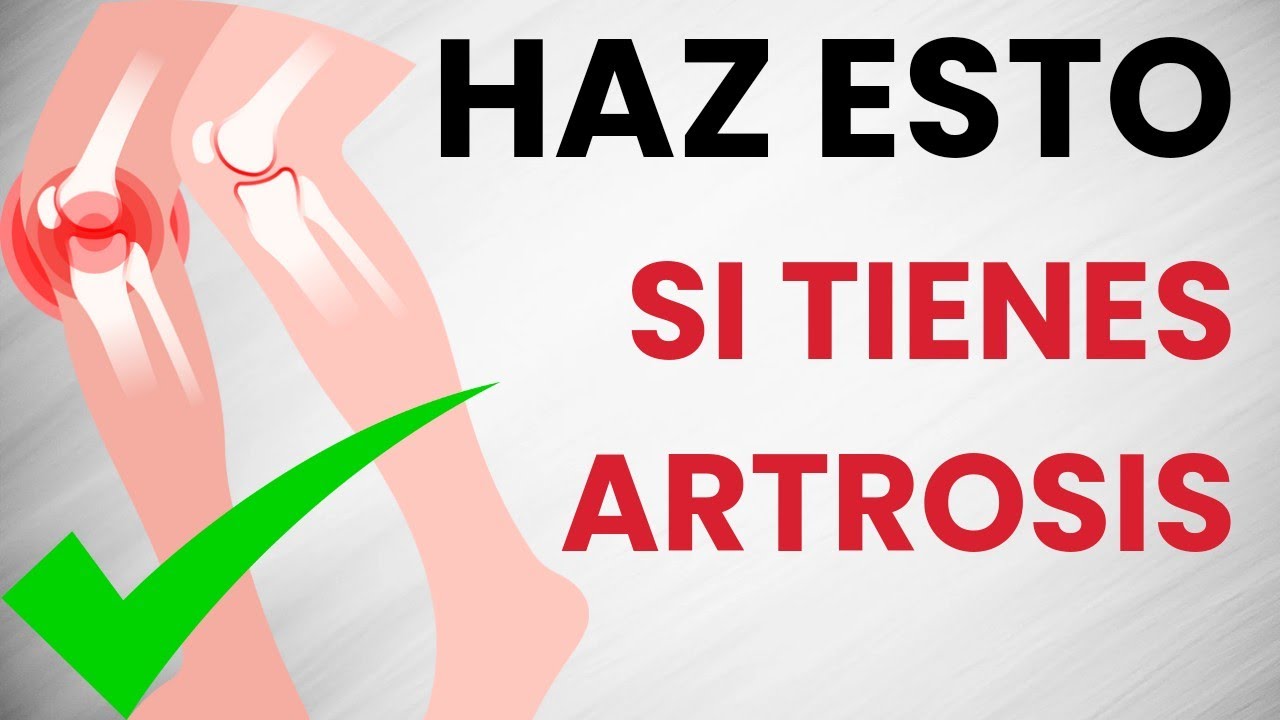 ✅ 6 Cosas que debes hacer para eliminar tu DOLOR de ARTROSIS
